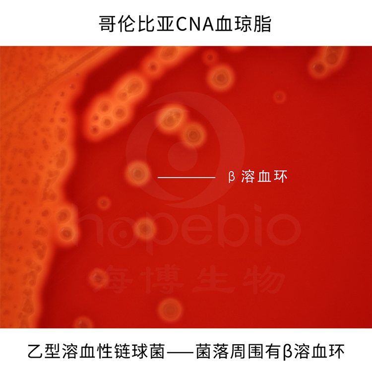 炐ȁCNAѪ֬Ѫ
