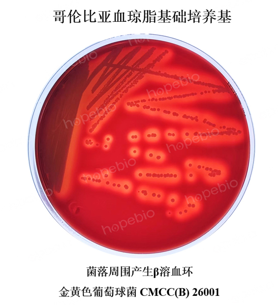 SɫCMCC(B)26001ڸ炐ȁѪ֬ϵľB(ti)