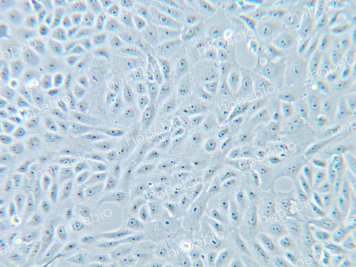 10rRNL(chng)VEROB(ti)