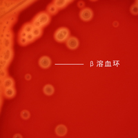 炐ȁCNAѪ֬Ѫ