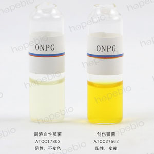 ONPG-ѪԻ(chung